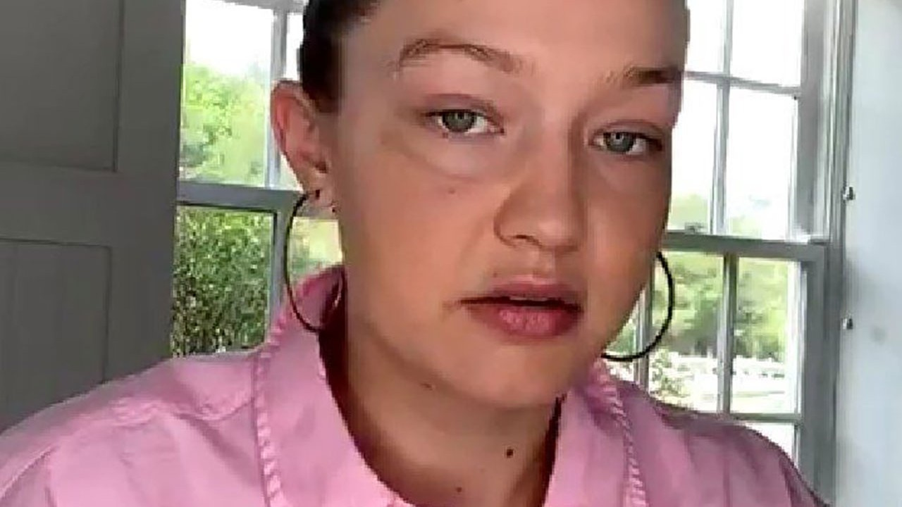 Ünlü modelin son hali şaşırttı! Hadise beğenmeyenlere tepki gösterdi