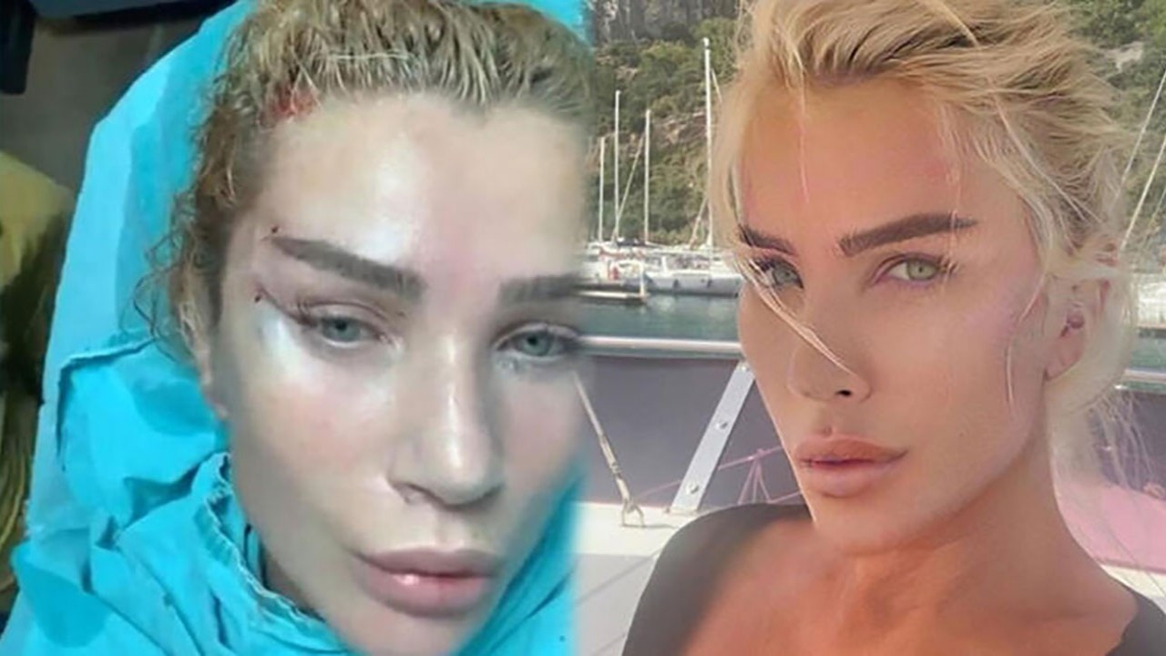 Fransız Askısı yaptıran Seda Sayan son halinin ilk fotoğrafını paylaştı