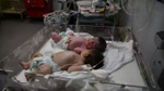 Gazze'de 2 bebek açlıktan hayatını kaybetti