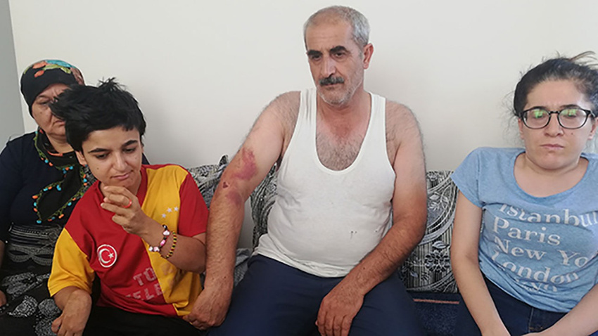 ‘Bana niye oy vermedin' dayağı
