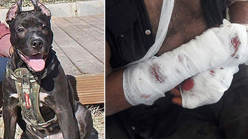 Pitbull sahibine saldırdı, polis vurarak kurtardı