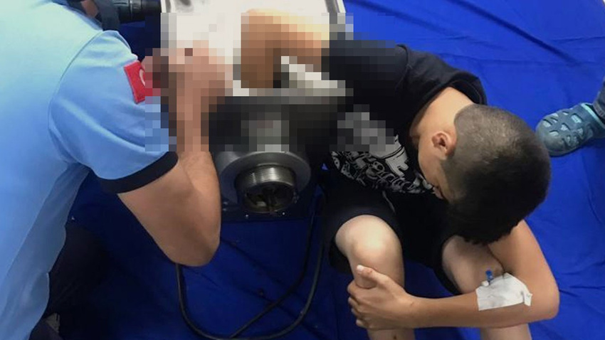 Kolunu kıyma makinesine kaptırdı