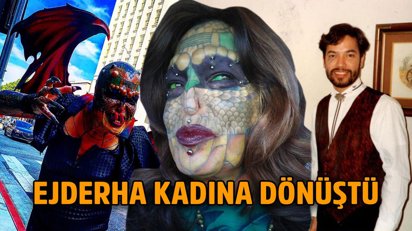 Çılgın adam ameliyatlara servet harcadı