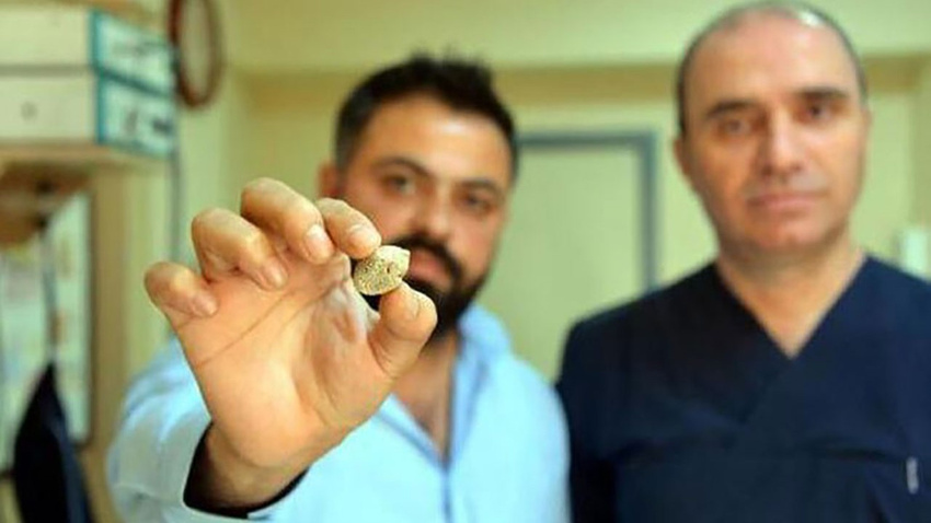 Doktorlar bile şaşırdı
