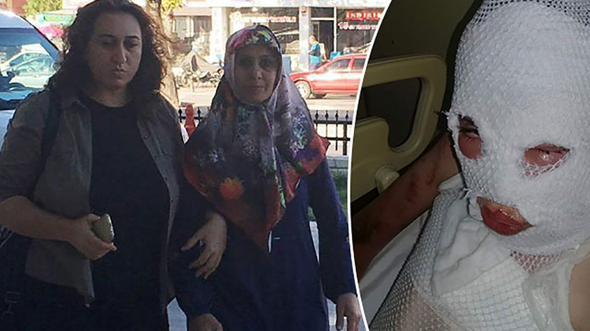 3'ü çocuk 6 kişiyi kezzapla yaktı! Pişman değil!