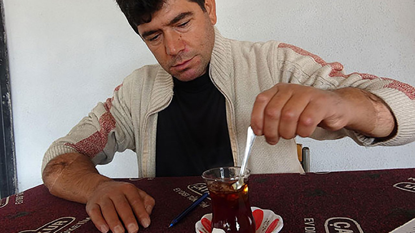 Çift kol nakli olan Topal odun kırıp tarla sürüyor