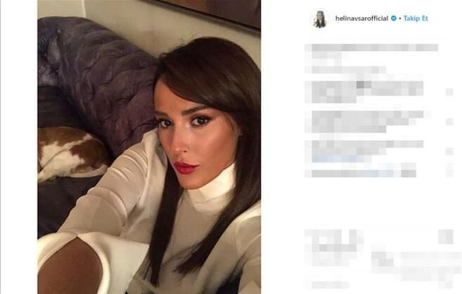 Estetikten sonraki Helin Avşar beğenilmedi - Sayfa 3