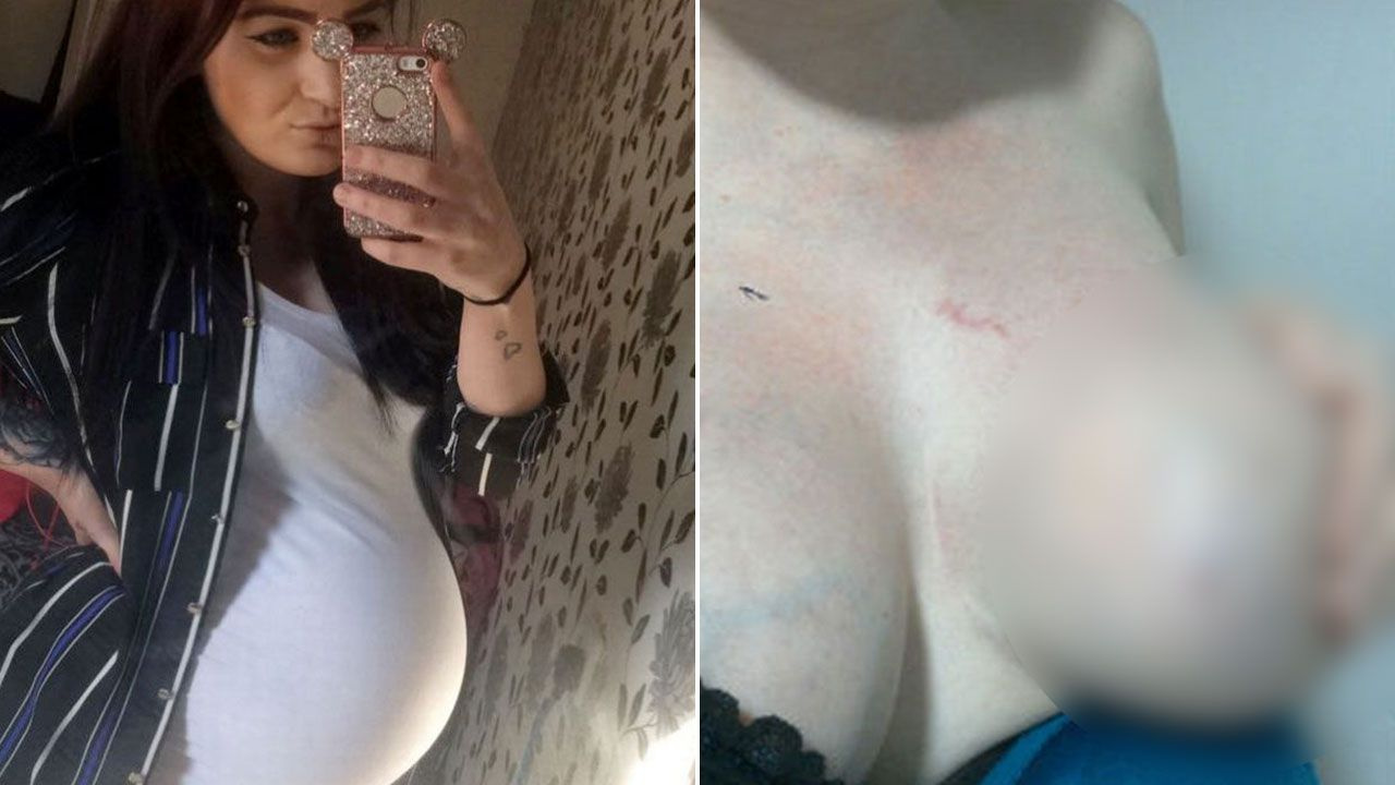 8 aylık hamile kadına ölümüne saldırdı - Sayfa 1