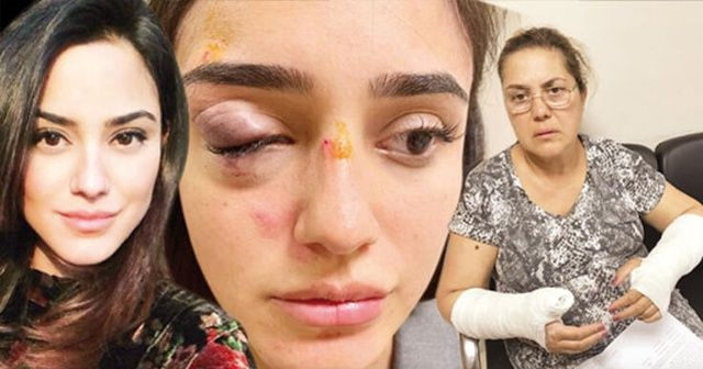 Ceren Kaplakarslan, yaşadığı dehşeti anlattı - Sayfa 1