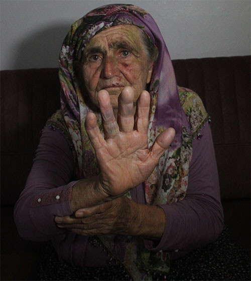 Fatma Altunöz'ün vücudunda ciddi yaralanmalar var.
