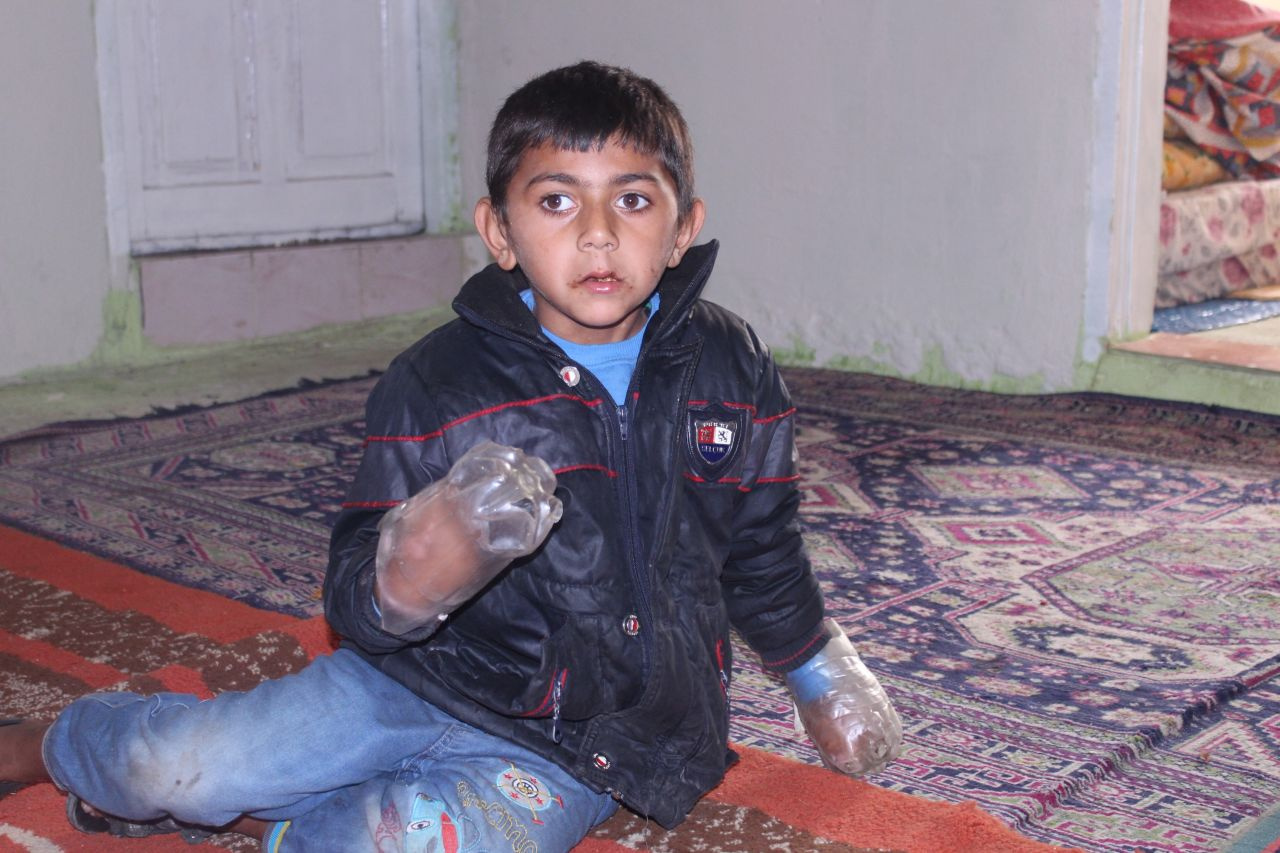 Isırdığı ellerini plastik şişeye bağlıyorlar - Sayfa 1