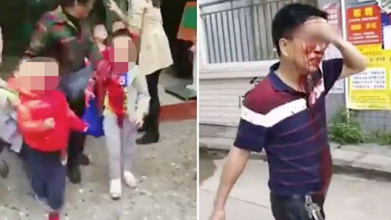 Çin'de anaokulunda bıçaklı saldırı: 18 yaralı