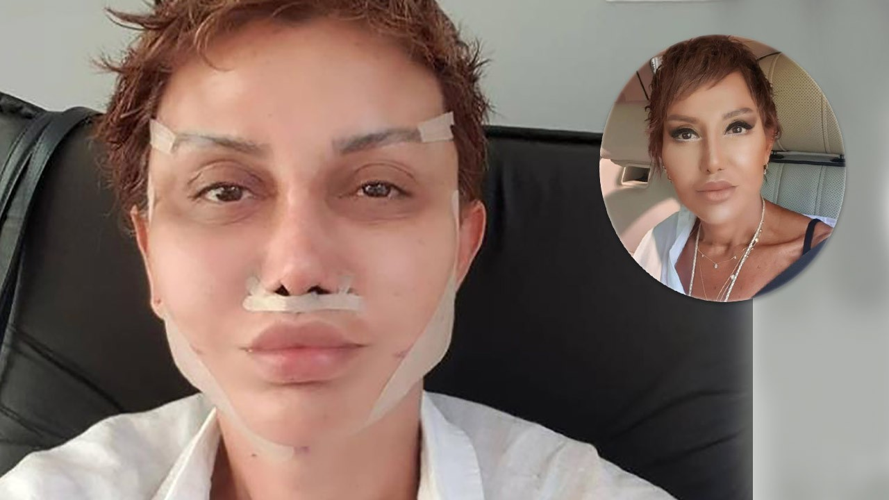 Estetik için Seda Sayan�ın doktoruna giden Serap Paköz�ün son hali!