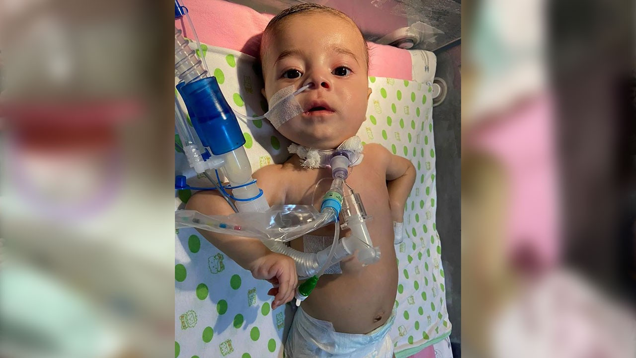 Adana�da yaşayan 5 aylık SMA tip 1 ölümcül kas hastası